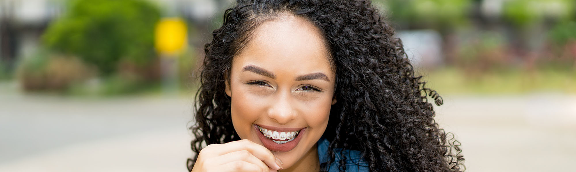 Orthodontics FAQs Carson CA